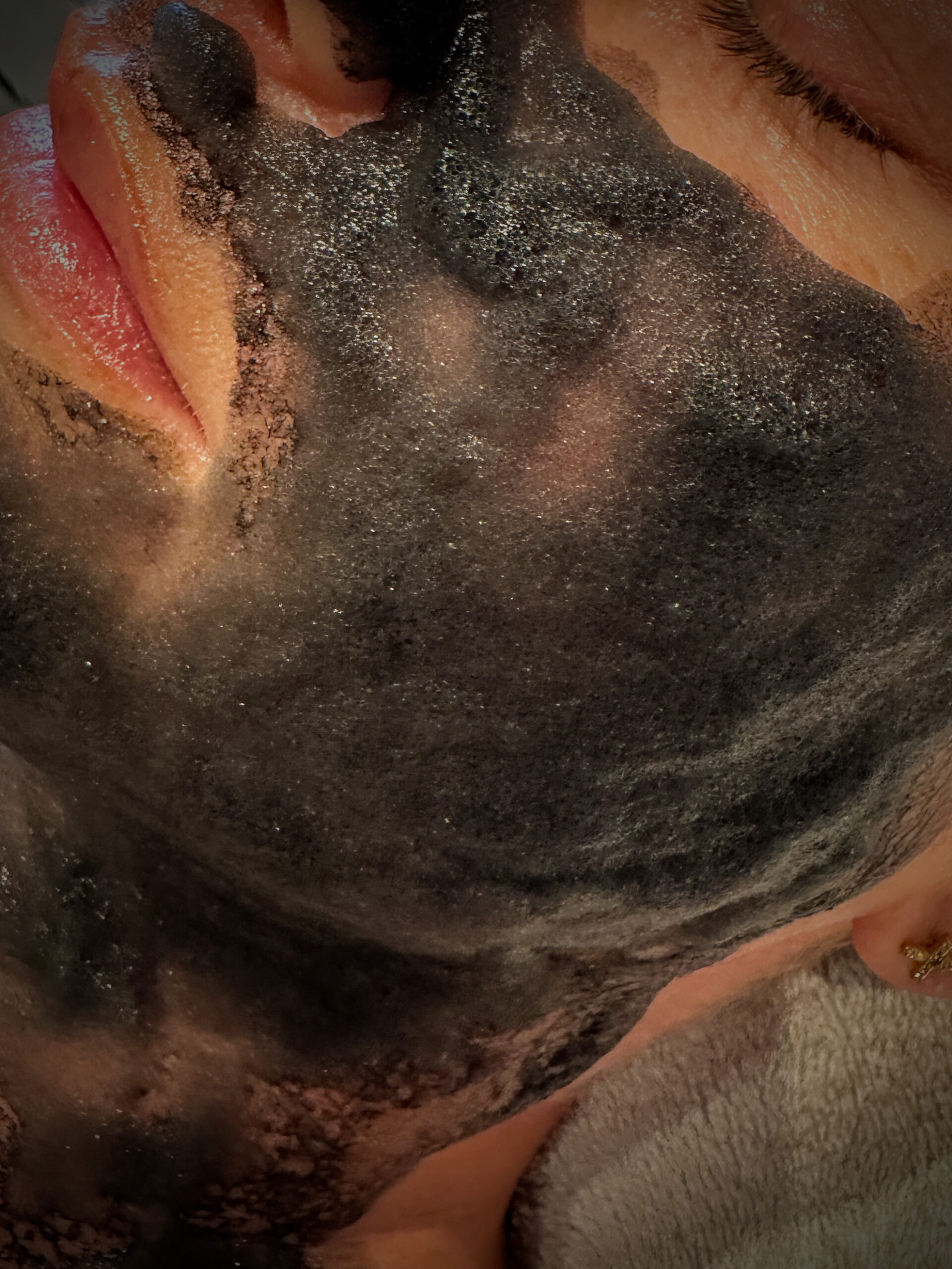 Ansigtsbehandlinger, skinpen, kosmetolog